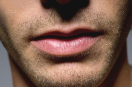 restylane silk lip injections for men
